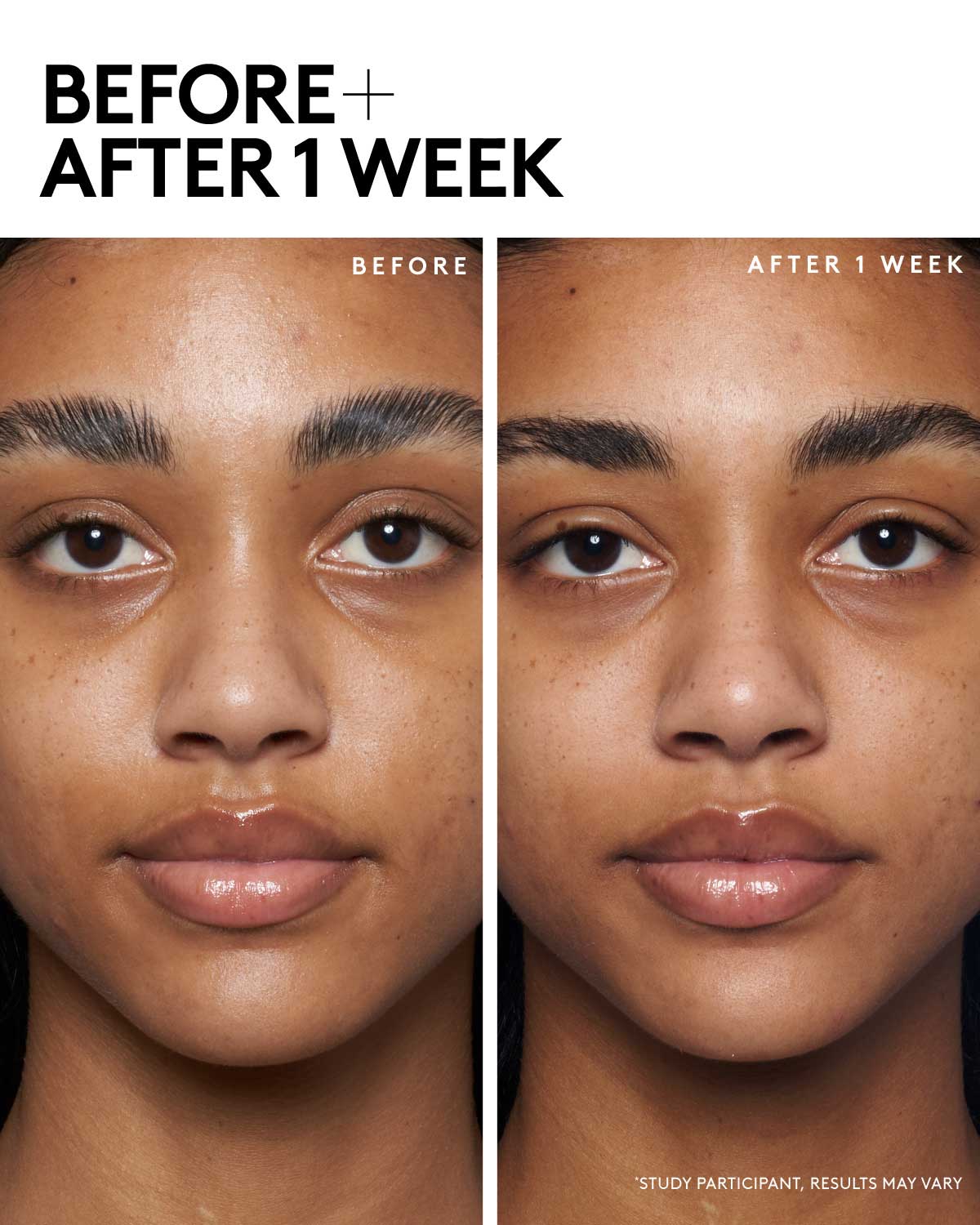 model image of model using blah to bright before and after 1 week