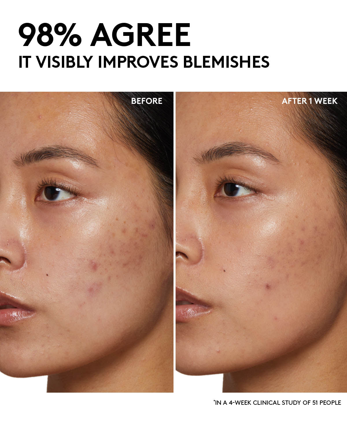 Fenty Skin Start’rs Full-Size Bundle with Mineral SPF: Oily Skin Edition
