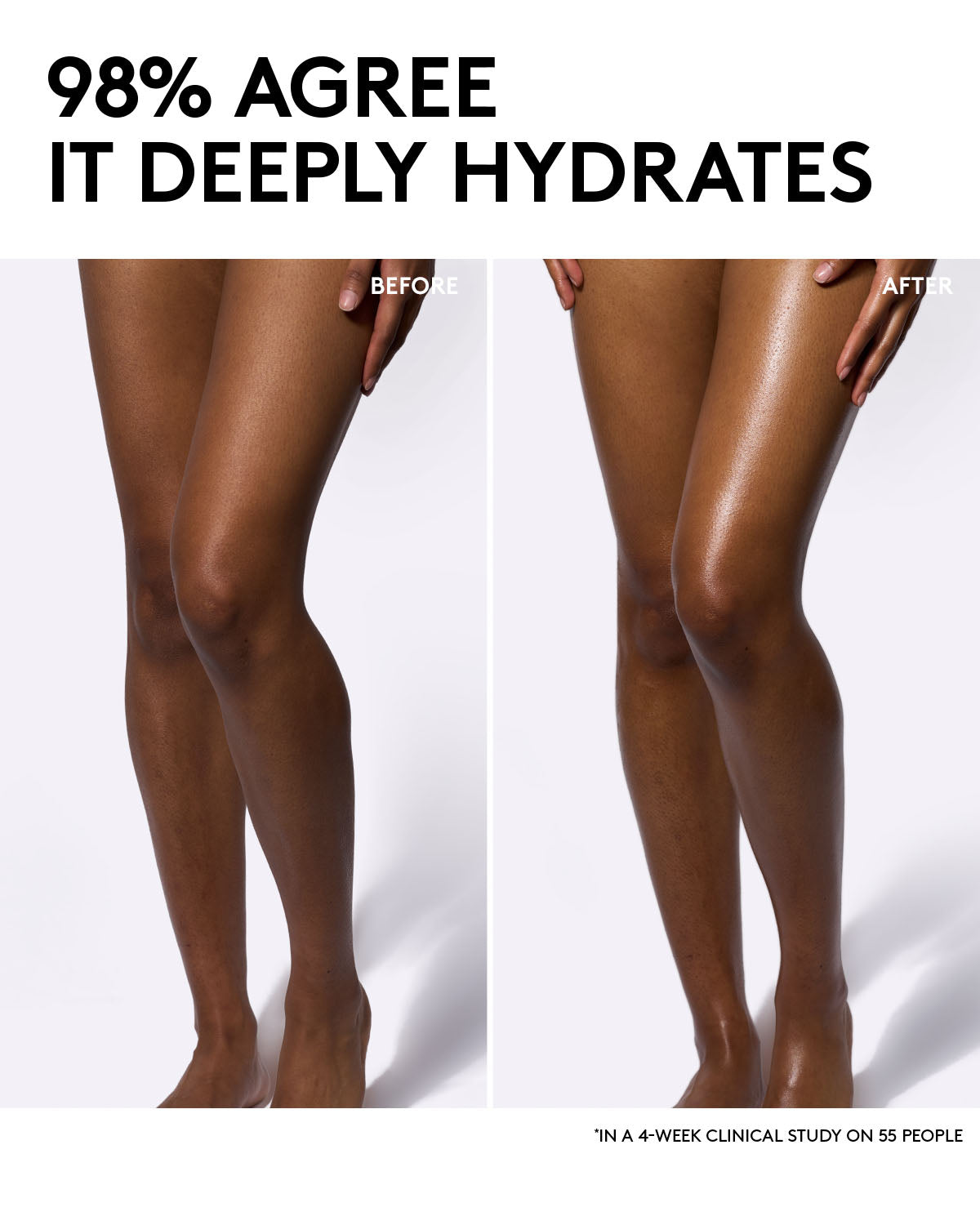 Before and after comparison of legs with hydration text.