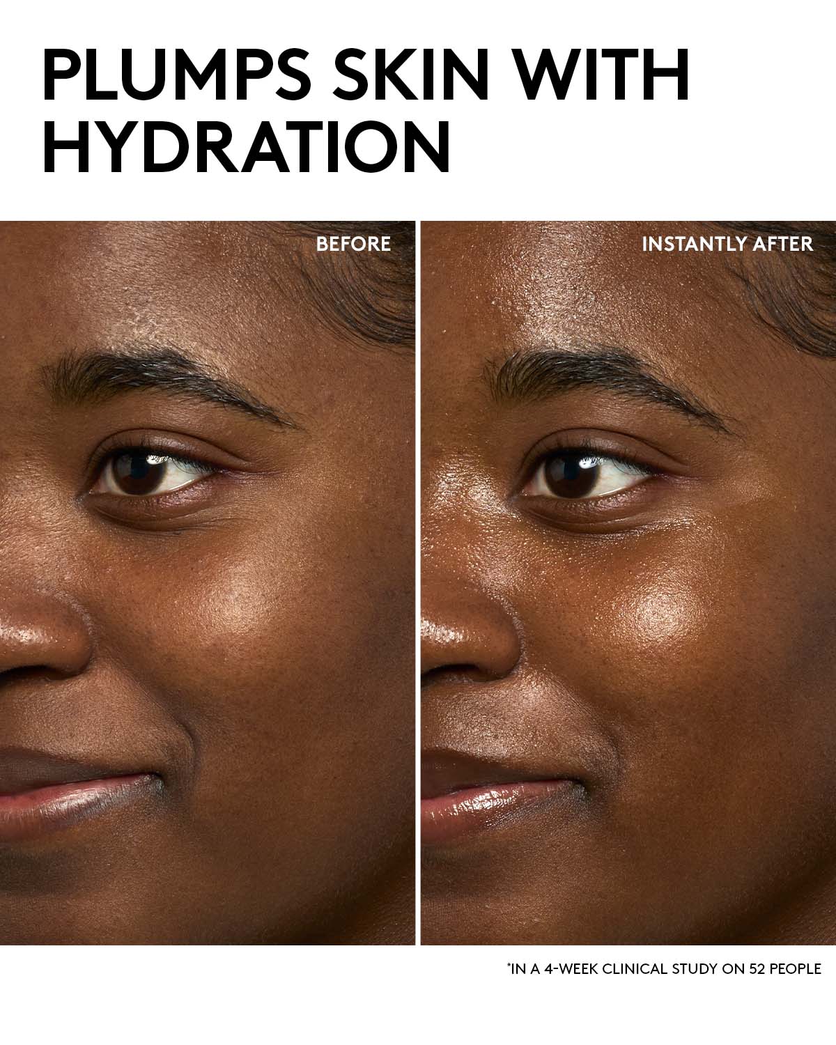 Day + Night Hydrating Routine: Dew N Plump Serum + Slushie Mask